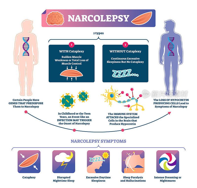 Narcolepsy vector illustration. Labeled muscle strength disease infographic